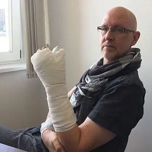 Verletzung 1 daumena